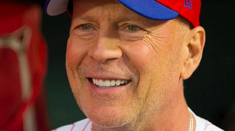 Bruce Willis Disease Bruce Willis Disease