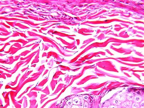 Dense Irregular Tissue Dense Irregular Tissue
