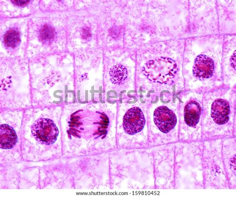 Mitosis Onion Cells Root Meristem Central Stock Photo 159810452 Mitosis Onion Cells Root Meristem Central Stock Photo 159810452