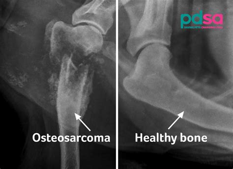 Osteosarcoma In Dogs