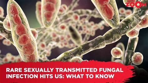 Sexually Transmitted Fungal Infections