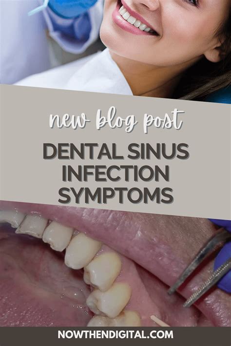 Sinus Infection Dental Pain