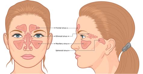 What Is The Connections With My Sinuses My Teeth Crimsoncare What Is The Connections With My Sinuses My Teeth Crimsoncare